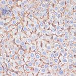 ApoA1 Antibody in Immunohistochemistry (Paraffin) (IHC (P))