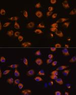 EphA5 Antibody in Immunocytochemistry (ICC/IF)