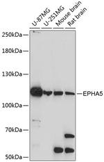 EphA5 Antibody in Western Blot (WB)