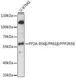 PPP2R5B Antibody in Western Blot (WB)