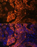 DR3 Antibody in Immunocytochemistry (ICC/IF)