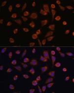 NDUFAF2 Antibody in Immunocytochemistry (ICC/IF)