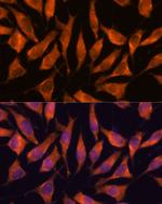 LHPP Antibody in Immunocytochemistry (ICC/IF)