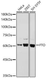 FTO Antibody in Western Blot (WB)