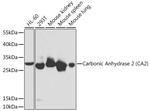 Carbonic Anhydrase II Antibody in Western Blot (WB)