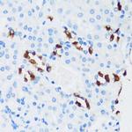 V-ATPase G3 Antibody in Immunohistochemistry (Paraffin) (IHC (P))