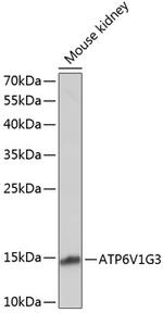 V-ATPase G3 Antibody in Western Blot (WB)