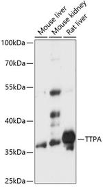 alpha TTP Antibody in Western Blot (WB)