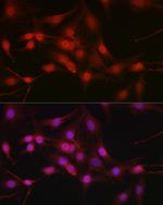 DYNLL1 Antibody in Immunocytochemistry (ICC/IF)