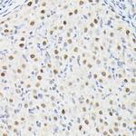 DYNLL1 Antibody in Immunohistochemistry (Paraffin) (IHC (P))