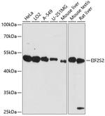 eIF2 beta Antibody in Western Blot (WB)