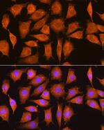 Nicastrin Antibody in Immunocytochemistry (ICC/IF)