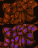 Nicastrin Antibody in Immunocytochemistry (ICC/IF)