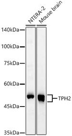 TPH2 Antibody in Western Blot (WB)