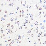 Calmodulin 3 Antibody in Immunohistochemistry (Paraffin) (IHC (P))