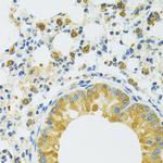 SLC37A4 Antibody in Immunohistochemistry (Paraffin) (IHC (P))