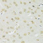 SLC37A4 Antibody in Immunohistochemistry (Paraffin) (IHC (P))