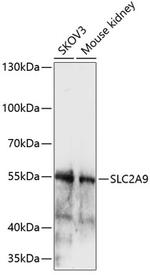 GLUT9 Antibody in Western Blot (WB)