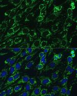 IDH3A Antibody in Immunocytochemistry (ICC/IF)