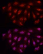 WTAP Antibody in Immunocytochemistry (ICC/IF)