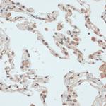 Thioredoxin 1 Antibody in Immunohistochemistry (Paraffin) (IHC (P))