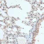 Thioredoxin 1 Antibody in Immunohistochemistry (Paraffin) (IHC (P))