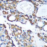 PDXDC1 Antibody in Immunohistochemistry (Paraffin) (IHC (P))