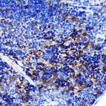 SWAP70 Antibody in Immunohistochemistry (Paraffin) (IHC (P))