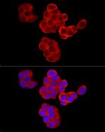 PABP Antibody in Immunocytochemistry (ICC/IF)