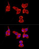 PABP Antibody in Immunocytochemistry (ICC/IF)