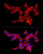 PABP Antibody in Immunocytochemistry (ICC/IF)