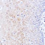 PABP Antibody in Immunohistochemistry (Paraffin) (IHC (P))