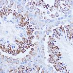 PABP Antibody in Immunohistochemistry (Paraffin) (IHC (P))