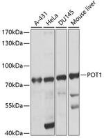 POT1 Antibody in Western Blot (WB)