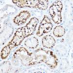 LDLR Antibody in Immunohistochemistry (Paraffin) (IHC (P))