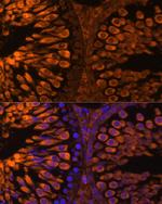 LDHC Antibody in Immunohistochemistry (Paraffin) (IHC (P))