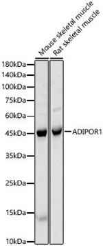 Adiponectin Receptor 1 Antibody in Western Blot (WB)