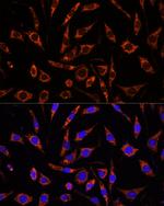 XK Antibody in Immunocytochemistry (ICC/IF)