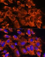 XK Antibody in Immunocytochemistry (ICC/IF)