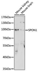 SPON1 Antibody in Western Blot (WB)