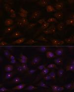 RNAse H2A Antibody in Immunocytochemistry (ICC/IF)