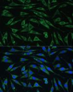 Dynamin 3 Antibody in Immunocytochemistry (ICC/IF)