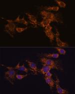 PYCR2 Antibody in Immunocytochemistry (ICC/IF)