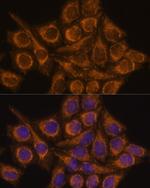 PYCR2 Antibody in Immunocytochemistry (ICC/IF)