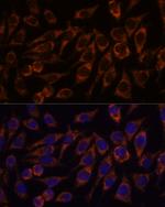 PYCR2 Antibody in Immunocytochemistry (ICC/IF)