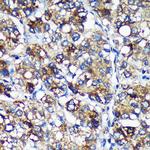 PYCR2 Antibody in Immunohistochemistry (Paraffin) (IHC (P))