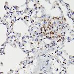 HDAC9 Antibody in Immunohistochemistry (Paraffin) (IHC (P))