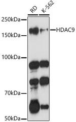 HDAC9 Antibody in Western Blot (WB)