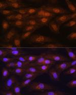 PRMT5 Antibody in Immunocytochemistry (ICC/IF)