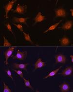 PRMT5 Antibody in Immunocytochemistry (ICC/IF)